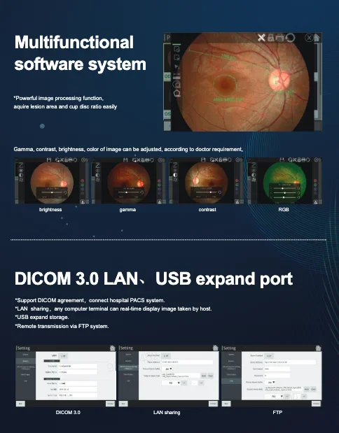 Desktop fundus camera FC-3100m