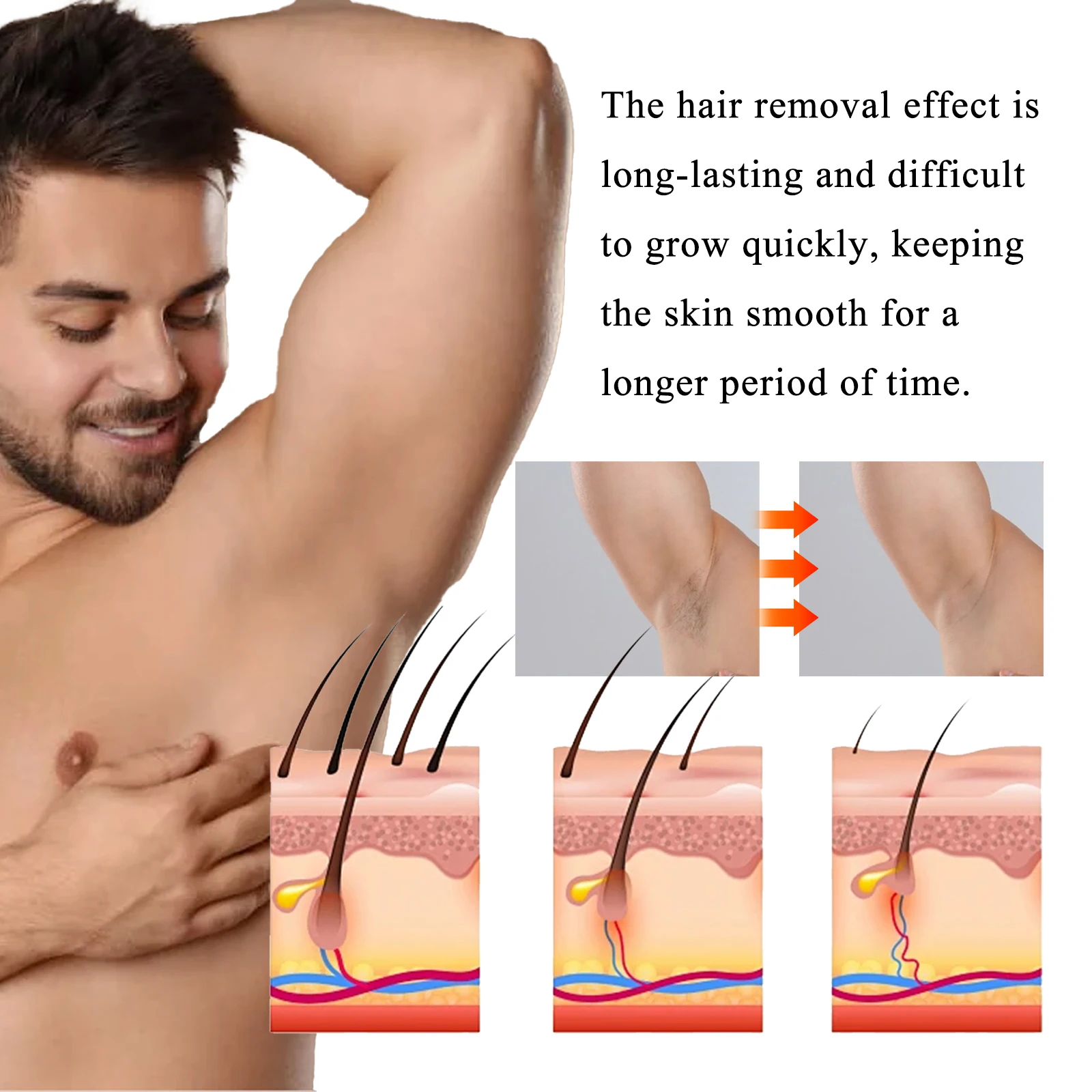 Men's Body Hair Removal Cream Painless Gentle Quick Depilatory Cream For Men Chest Arm Leg Back Smooth Hair Remover