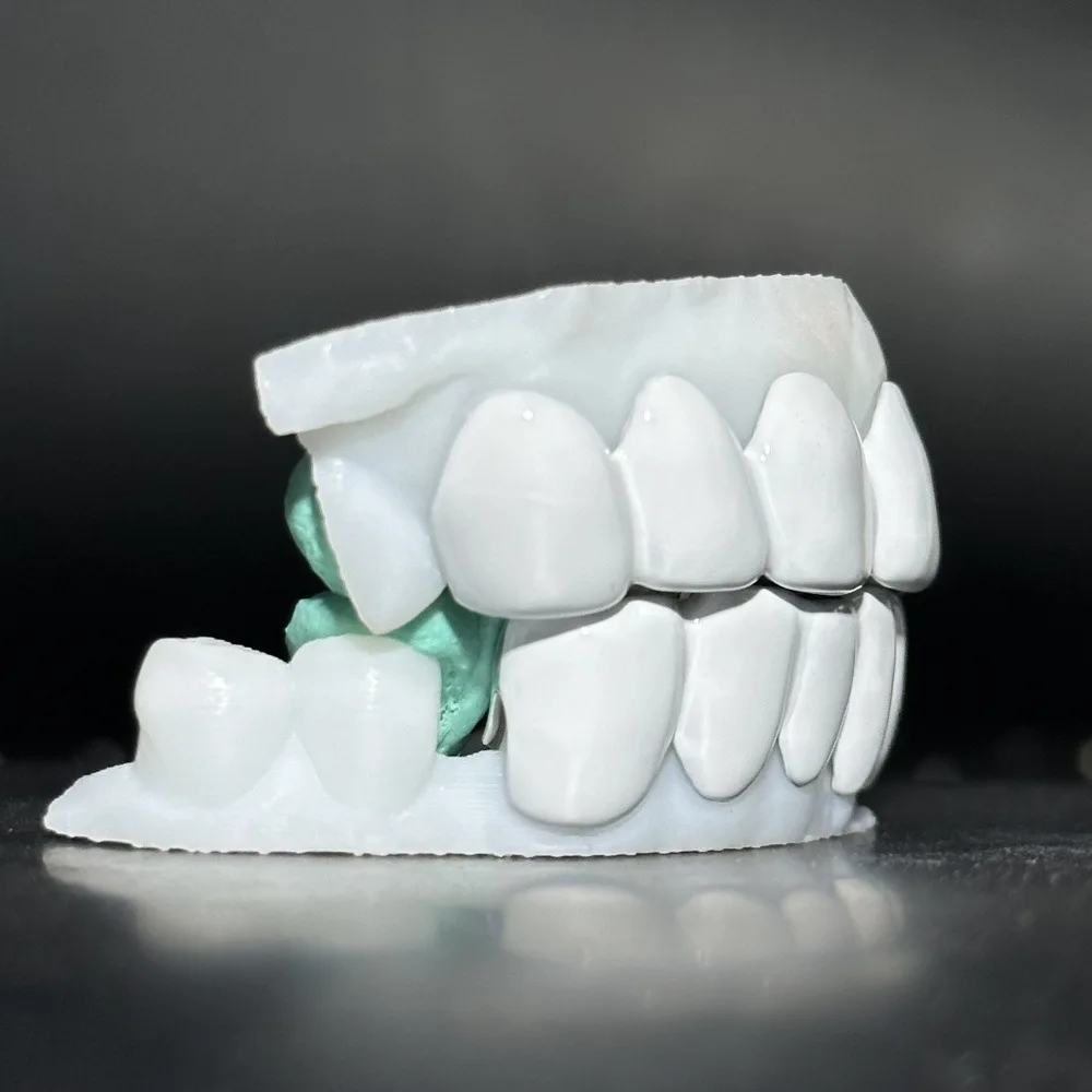 White Enamel Top 6 Bottom 6 Tooth Grill European And American Cross-border Hot-selling