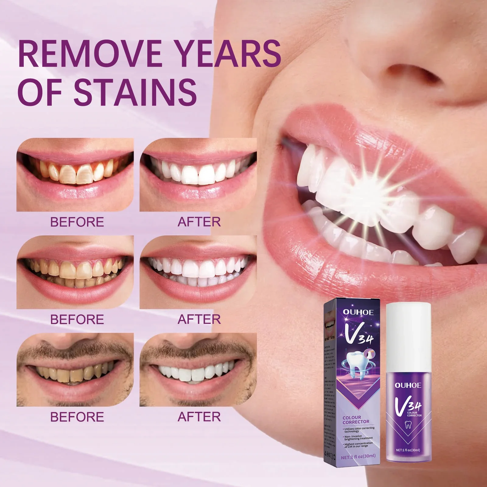 5pcs 30ml V34 Purple Toothpaste Removes Tartar Cleans Oral Hygiene Freshens Breath Brightens Teeth Care Products