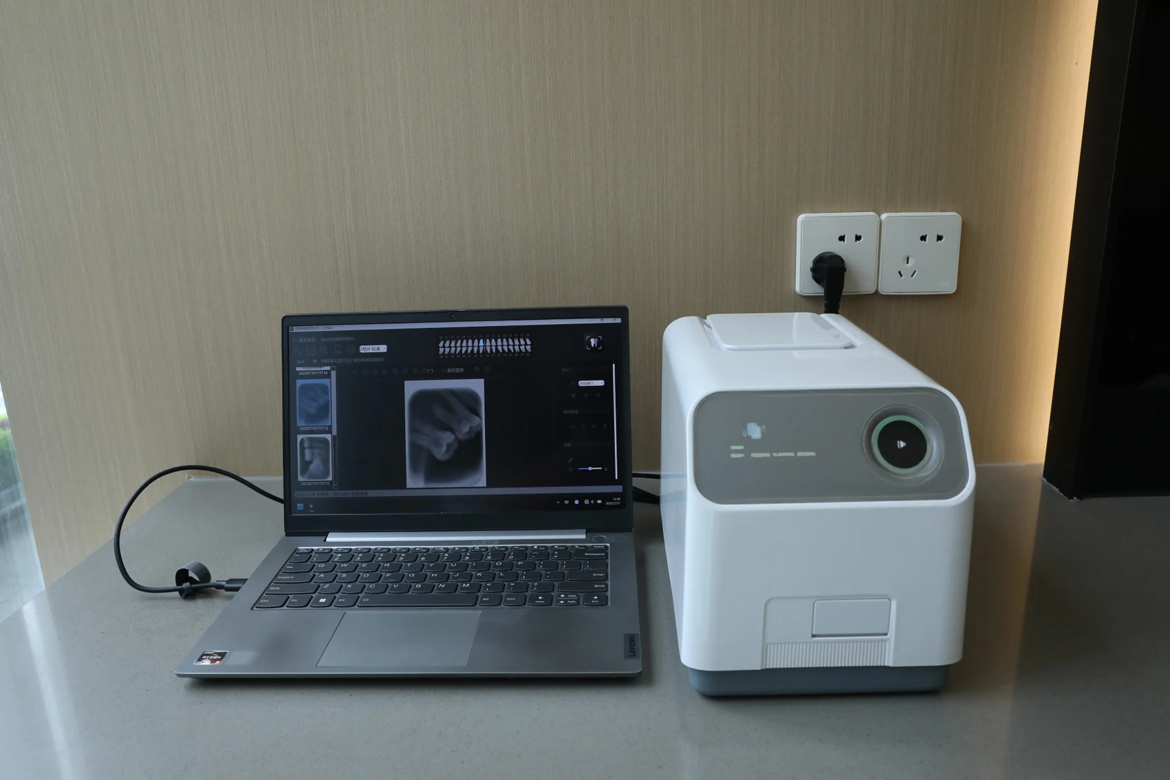 وافق CE ISO عالي الدقة 17lp/mm ماسح لوحة صورة PSP للأشعة السينية للأسنان #5