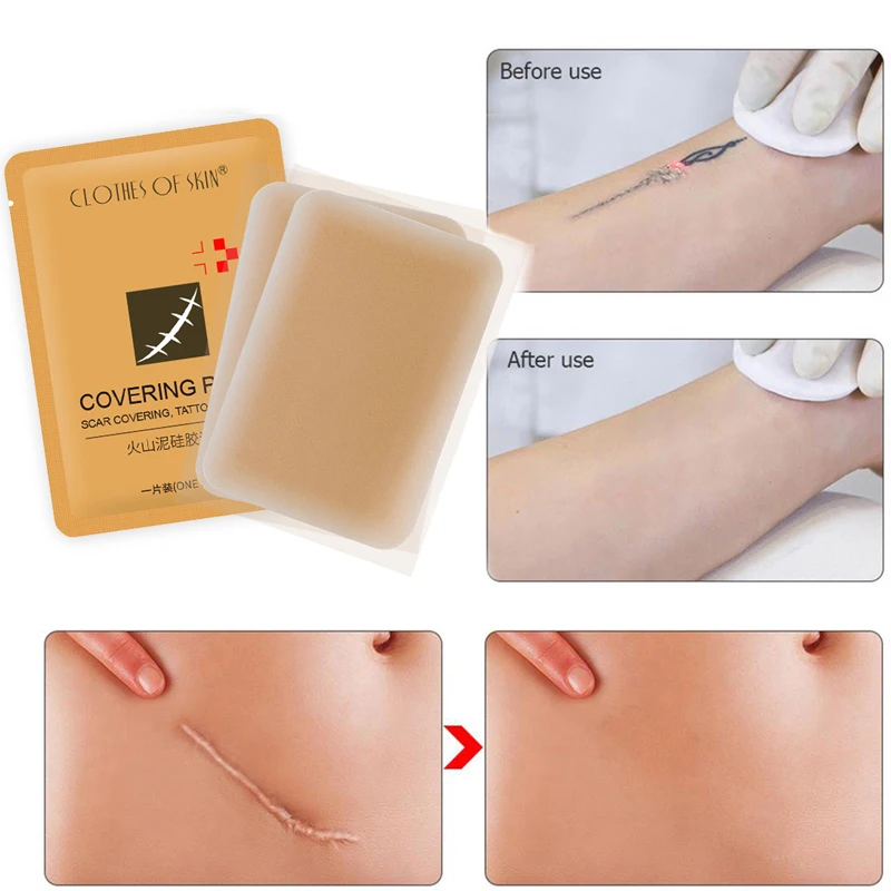 Instantly Tattoo Scar Cover Up Body Flaw Concealer Patches Skin Invisible Blemish Covering Sticker Waterproof Scar Treatment