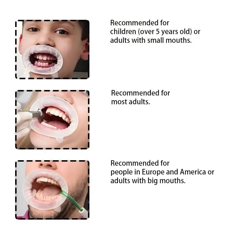Dentaler Mundöffner 3D Lippen-Wangen-Retraktor O-förmiger Gummi-Expander für orale Untersuchungen und Behandlungsverfahren – Detail 5