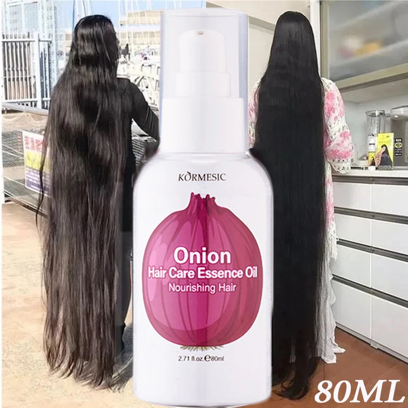 Onion Hair Growth Serum Spray Promotes Hair Growth Oil Repair Hairs Damage Prevent Hair Loss Nourish Scalp Hair Health Care 80ml