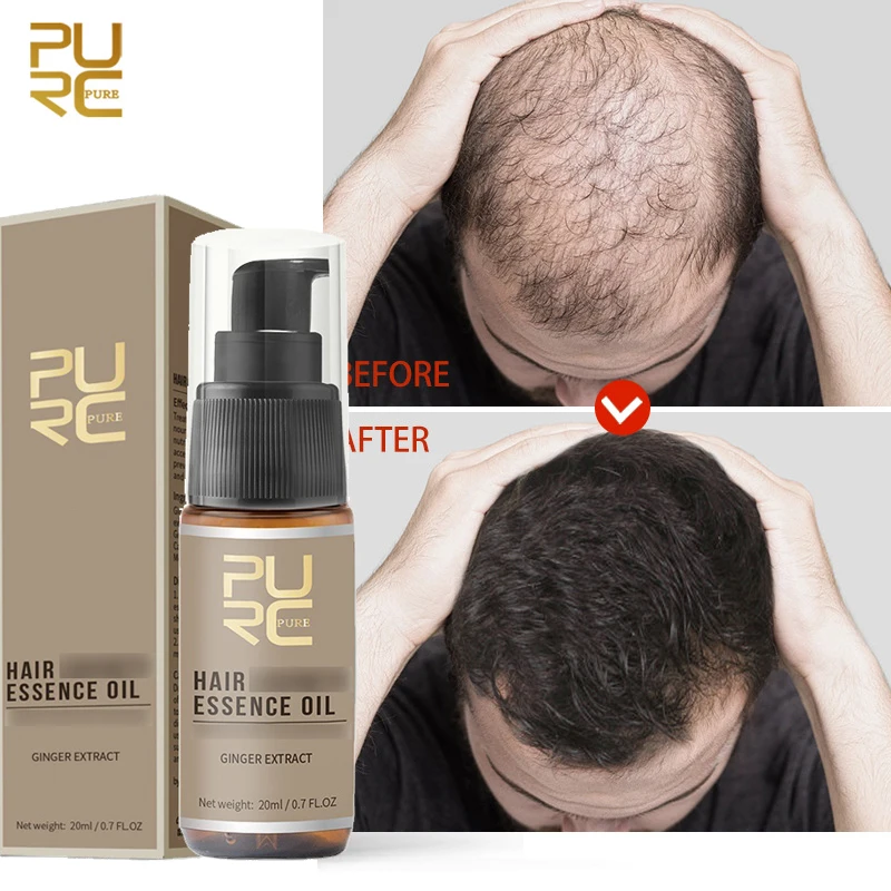 Ginger Fast Hair Growth Serum Anti Hair Loss Regrowth Thicker Hair Care Oil Scalp Treatment Beauty Health Products for Men Women