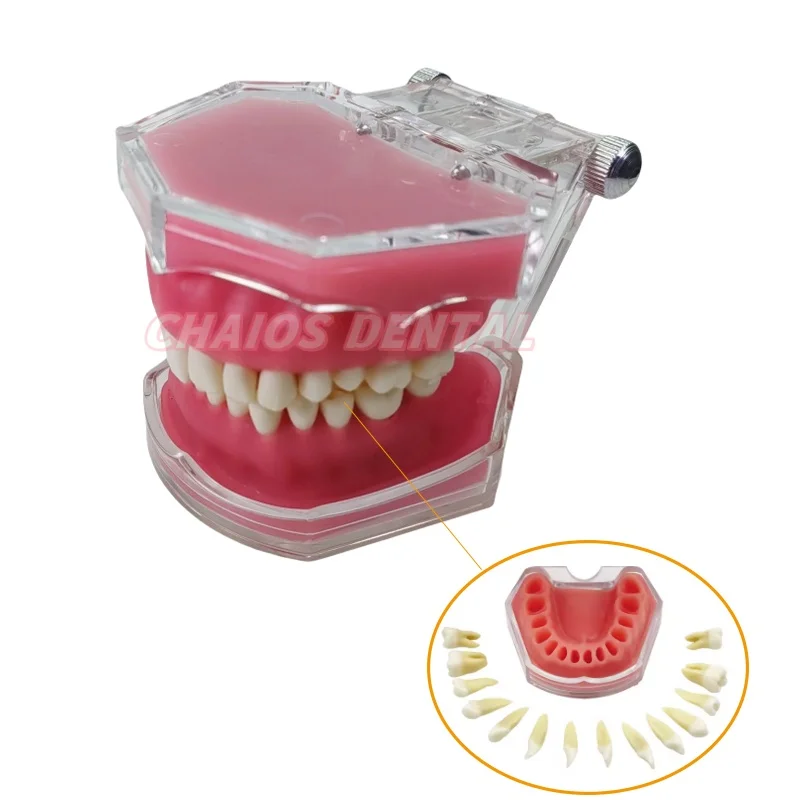 1Pcs Extraction Model Dental Standard Typodont Model Soft Gum With 28 Removable Teeth Adult Practice Model For Dentist Teaching