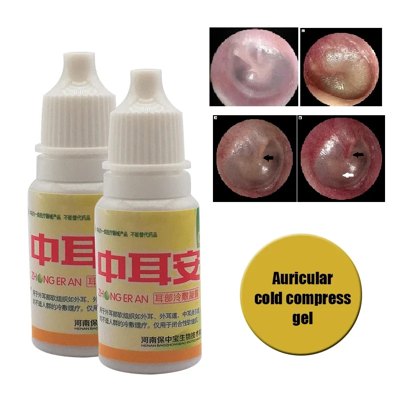 Otite aguda líquida de orelha gotas, Fitoterapia chinesa para ouvido, Surdez zumbido, Cuidados com a saúde, Ear Cleansing Drops, 4pcs