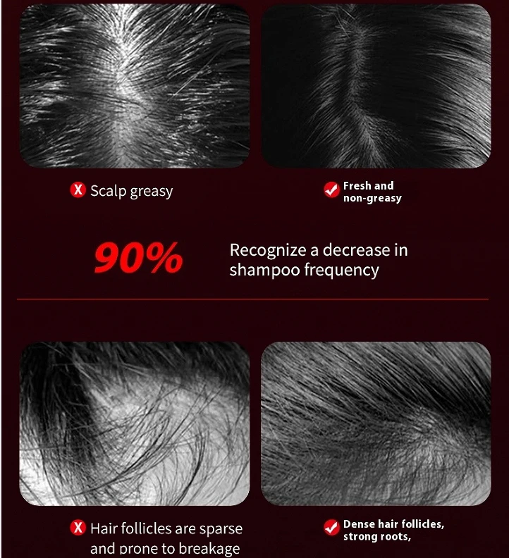 مشط تدليك فروة الرأس الكهربائي من LL لنمو الشعر ومضاد لتساقط الشعر، علاج احترافي باللون الأحمر، فرشاة شعر سحرية، أداة توزيع الزيت #5