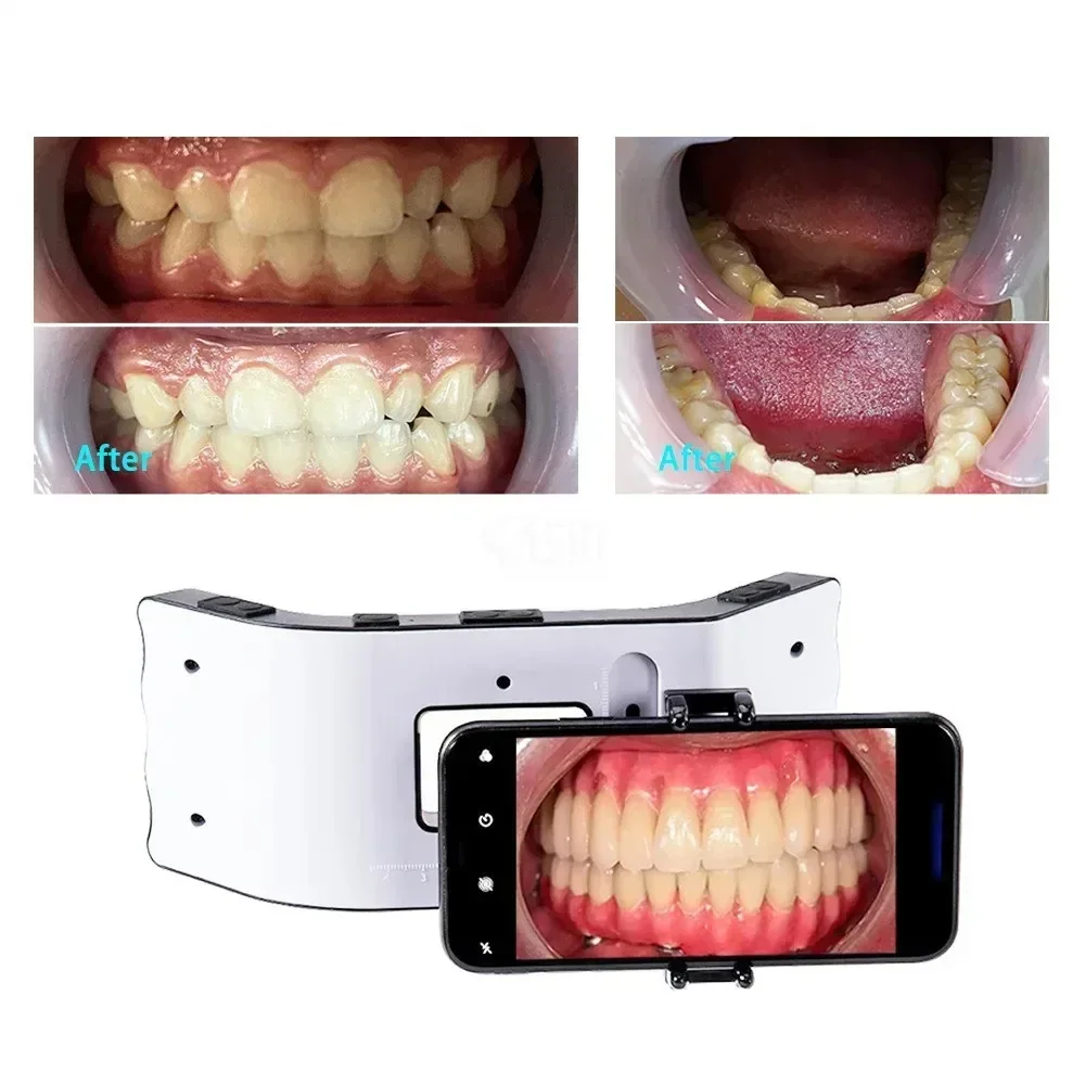 

2025 New Flash Light with Holder Photography Oral Filling Lamp Fotografia Orthodontics Equipment Light Environment Photo Lamp
