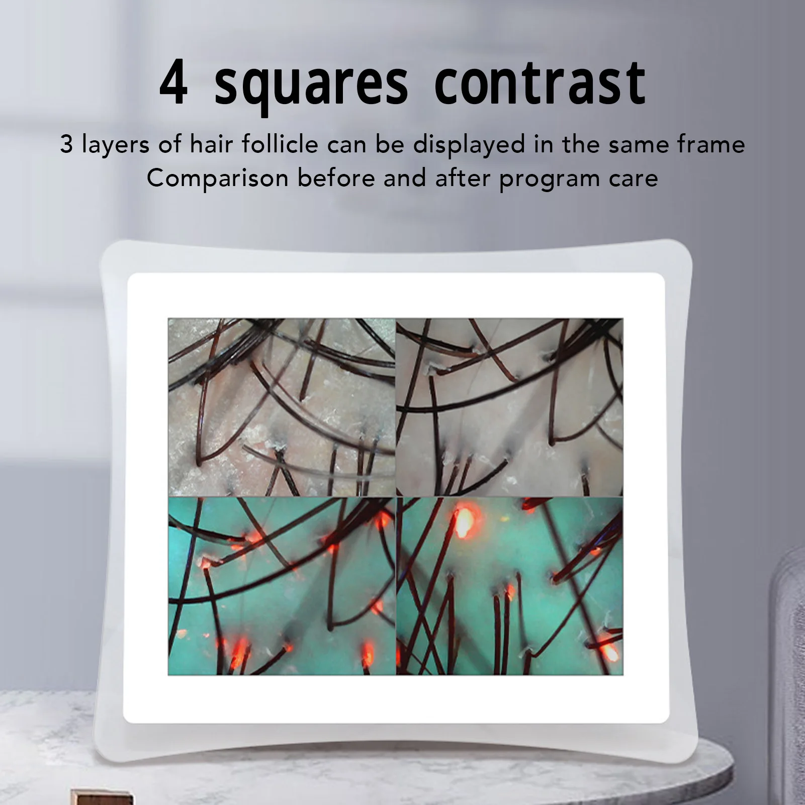 Huidfollikel Detector 17 inch Huid Haar Analysis Machine 50X 200X Vergroting 3 Lichtmodi Follikel Hoofdhuid Detectie Instrument