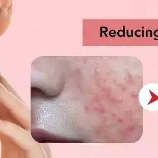 7 in 1 RF&EMS マイクロカレントリフティングデバイス 振動 LED フェイススキン若返りしわ除去アンチエイジングフェイシャルビューティーデバイス