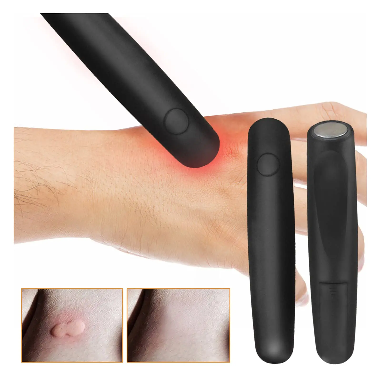 Electronic Mosquito Bite Pen Relief Burning Pain & Swelling Relieve Stings Pen Mosquito Against Portable Tool for Summer