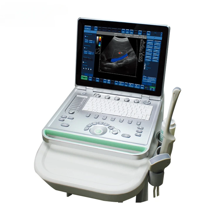 TOP-A1054 portable diagnostic ultrasound machine price / portable ultrasound scanner price china