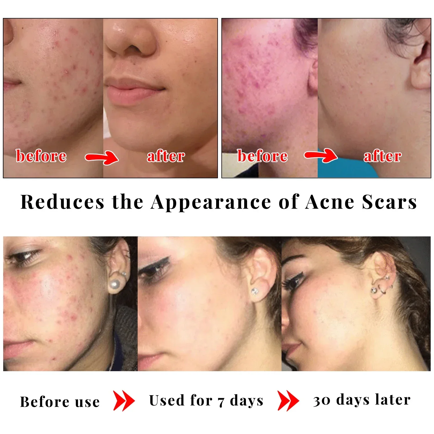 KoJic-ハンドホワイトニングソープ,明るい製品,メラニン,変形,黒点の除去,肌のトーンを改善