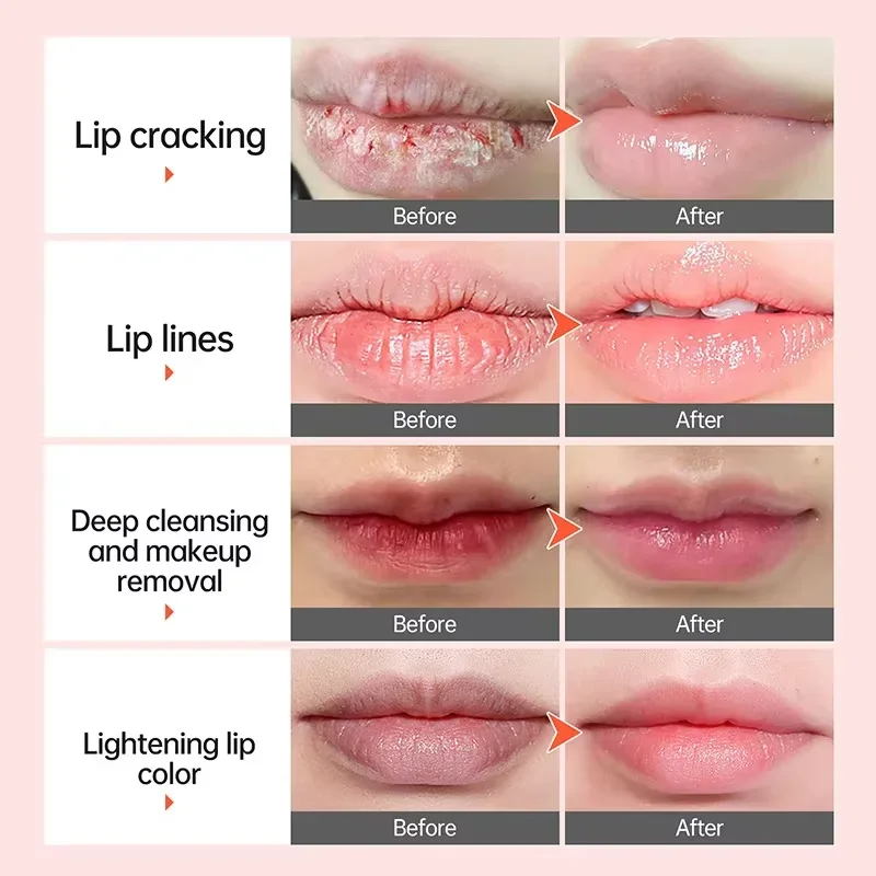 Pelembap bibir penghilang gelap cepat, pencerah bibir merah muda, Eksfoliasi bibir memudarkan garis bibir pelembap kulit mati, produk perawatan kesehatan kecantikan Korea