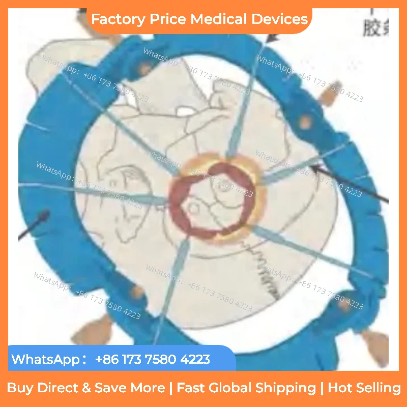 

2026 Disposable surgical retractor, Saison disc-type skin ring retractor silicone strip hooks for various surgical