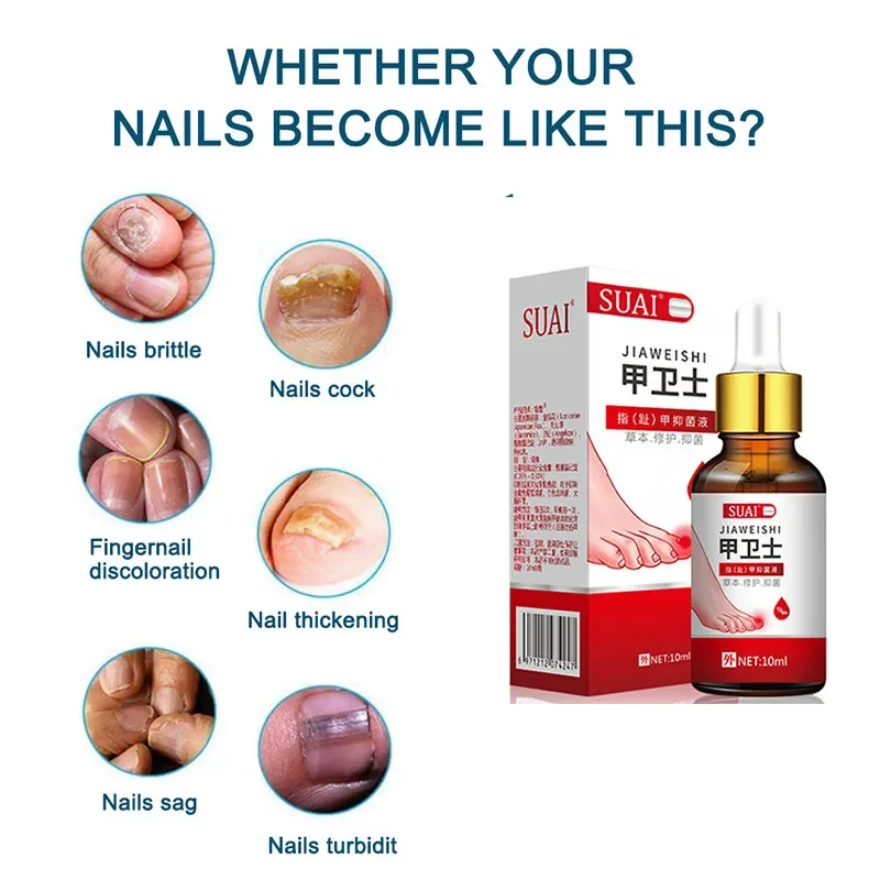 جديد علاج فطريات الأظافر تو الفطريات إزالة هلام باديكير مكافحة العدوى مسمار الجلد العناية بالقدم جوهر الفطريات اليد القدم Repai