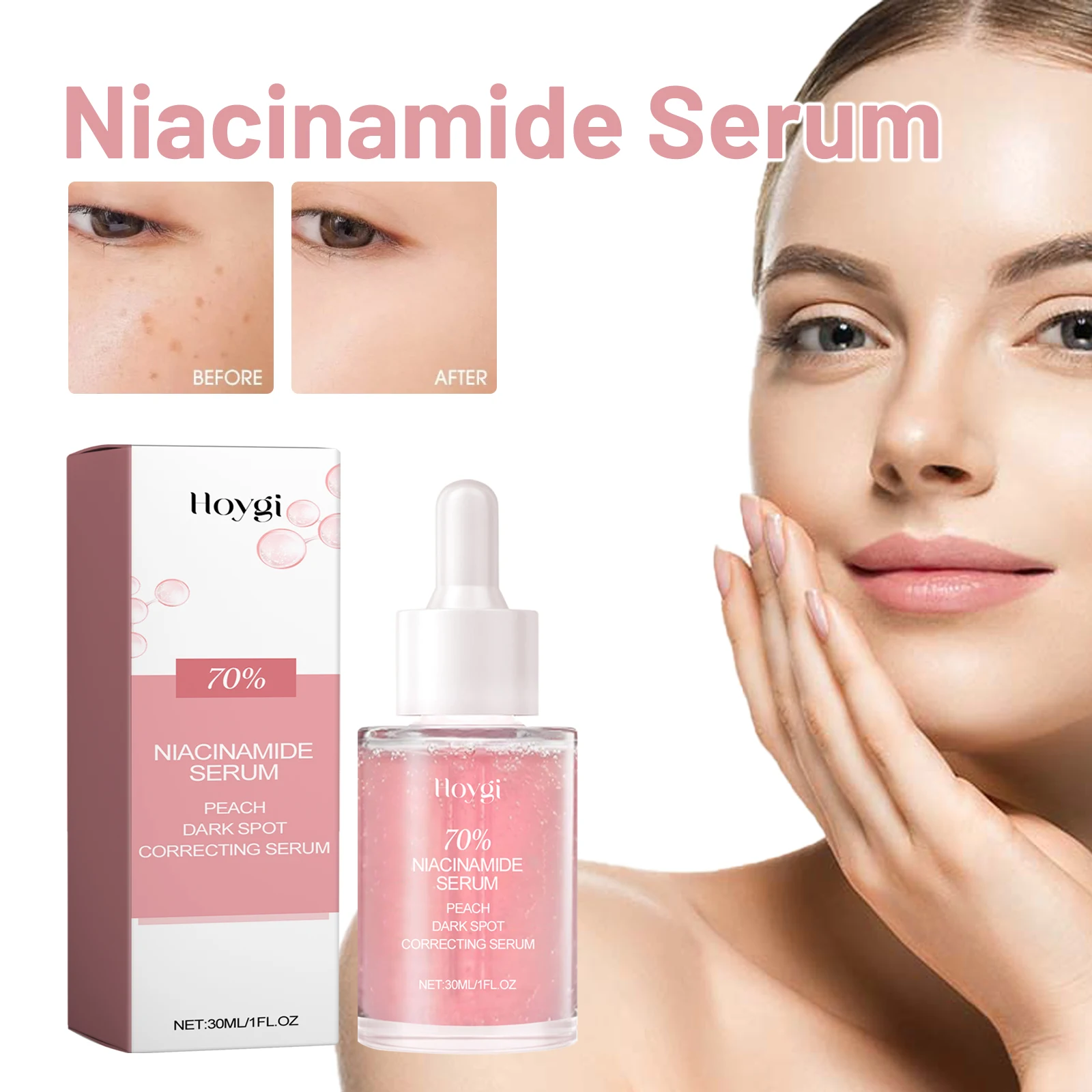 Hoygi Niacinamide Serum, Hydrating and Moisturizing, Improving Dullness, Translucency, Delicate Pores, and Brightening Facial Water and Light Muscles