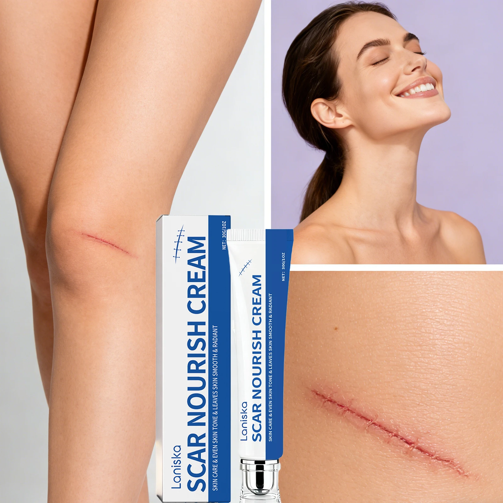 Scar Nourish Cream Fade-Out Skin Marks Even Skin Tone Scar Repairing Ointment Deep Hydration Nourishing Smoothing Body Skin Care