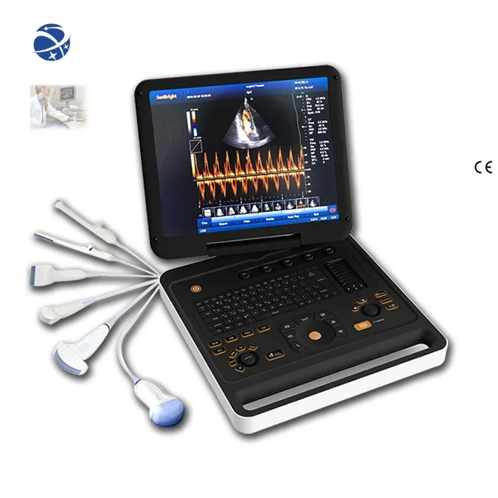 906B Hot Sales Medical Equipment portable 3D 4D Color Doppler machines imager for Humans