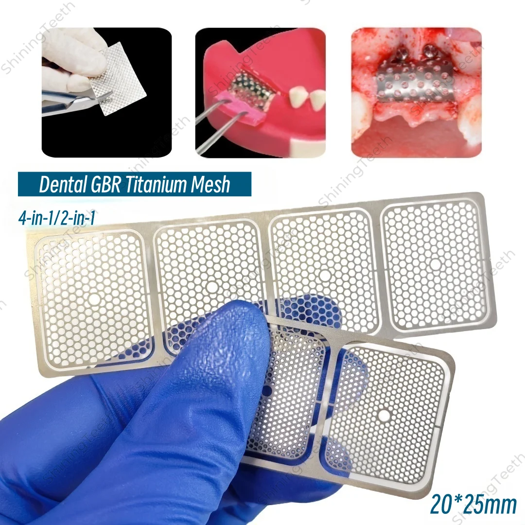 

Dental Titanium Barrier Membrane Mesh Plates GBR Flexible and safety Titanium Mesh Membrane Silver 2-in-1/4-in-1