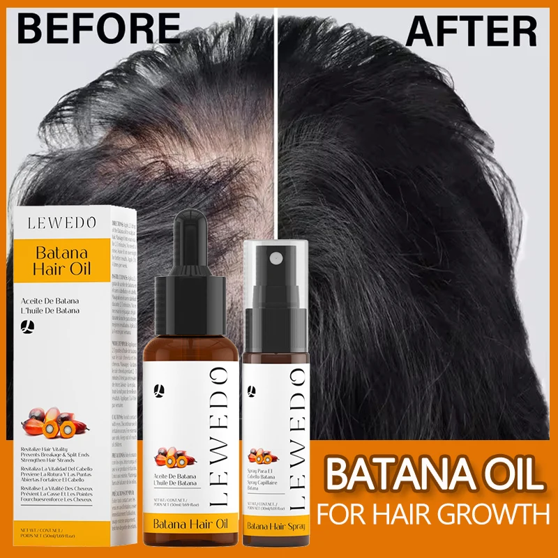 

Сыворотка для роста волос Batana, эфирное масло против выпадения волос, восстановление кожи головы, поврежденные волосы, спрей для ухода за волосами, эфирное масло для утолщения волос