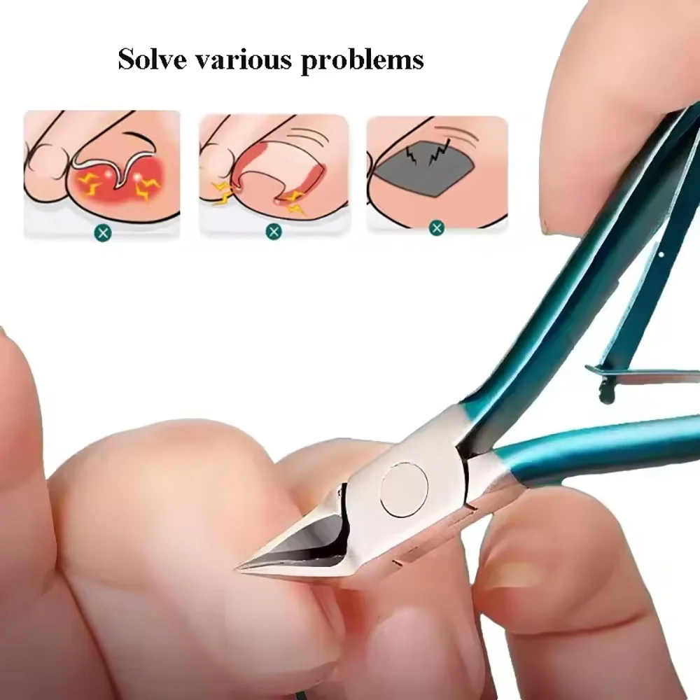 Tagliaunghie per unghie incarnite spesse Tagliaunghie professionale per unghie dei piedi Durevole podologo Pinza per unghie dei piedi Strumento per la cura delle unghie antiruggine ‌ s