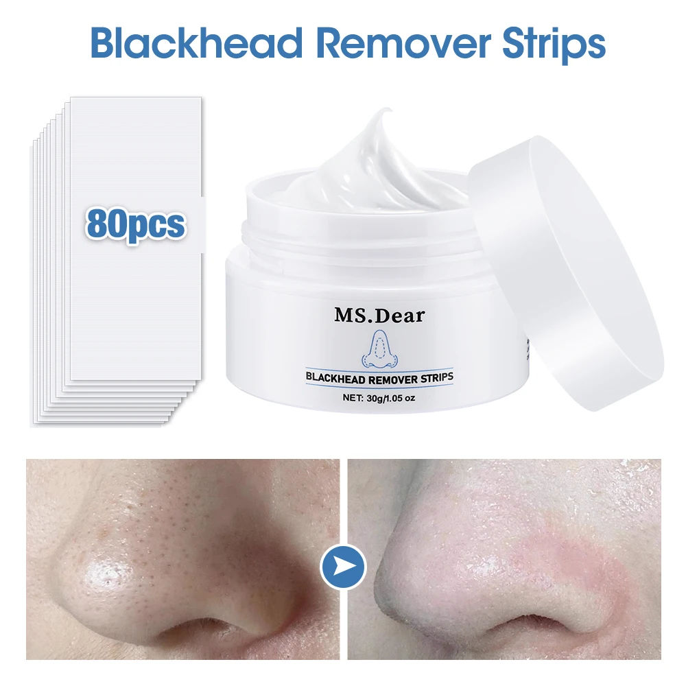 Novo removedor de cravo nariz máscara poros tira com 80 pçs papel limpeza profunda do rosto tiras nasais peeling tratamento acne cuidados com a pele