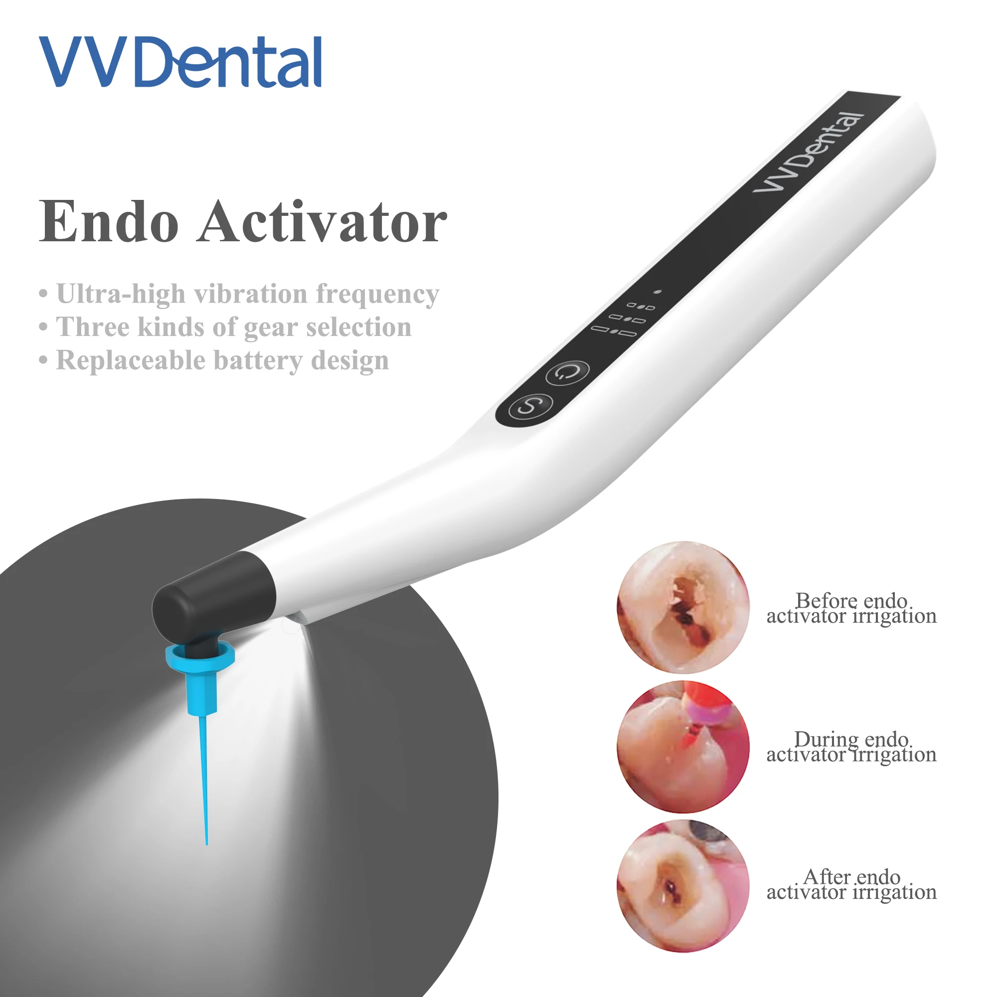 VV Dental Wireless Endodontic Treatment Root Tool With LED Light Dental Teeth Cleaning Equipment Endo Activator With 60 Pcs Tips