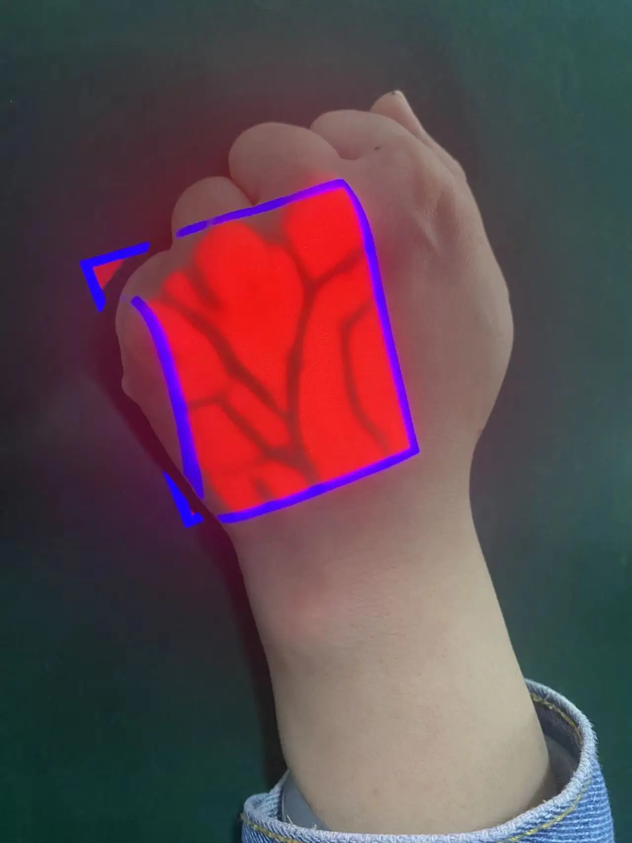 thumb