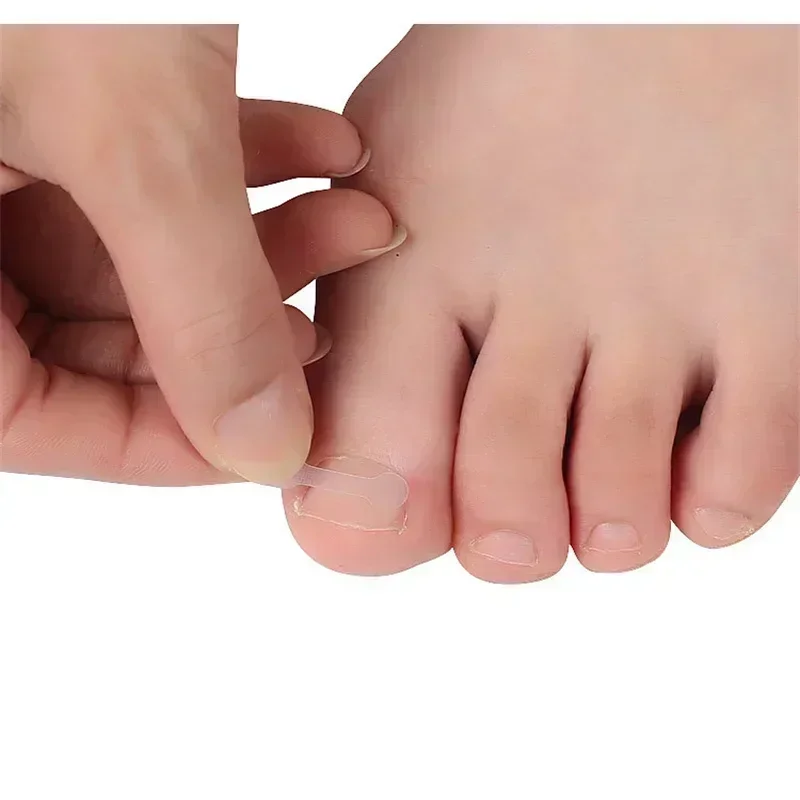 Dispositivo de corrección de uñas encarnadas, parche para uñas de los pies, juego de pedicura, tira adhesiva rápida