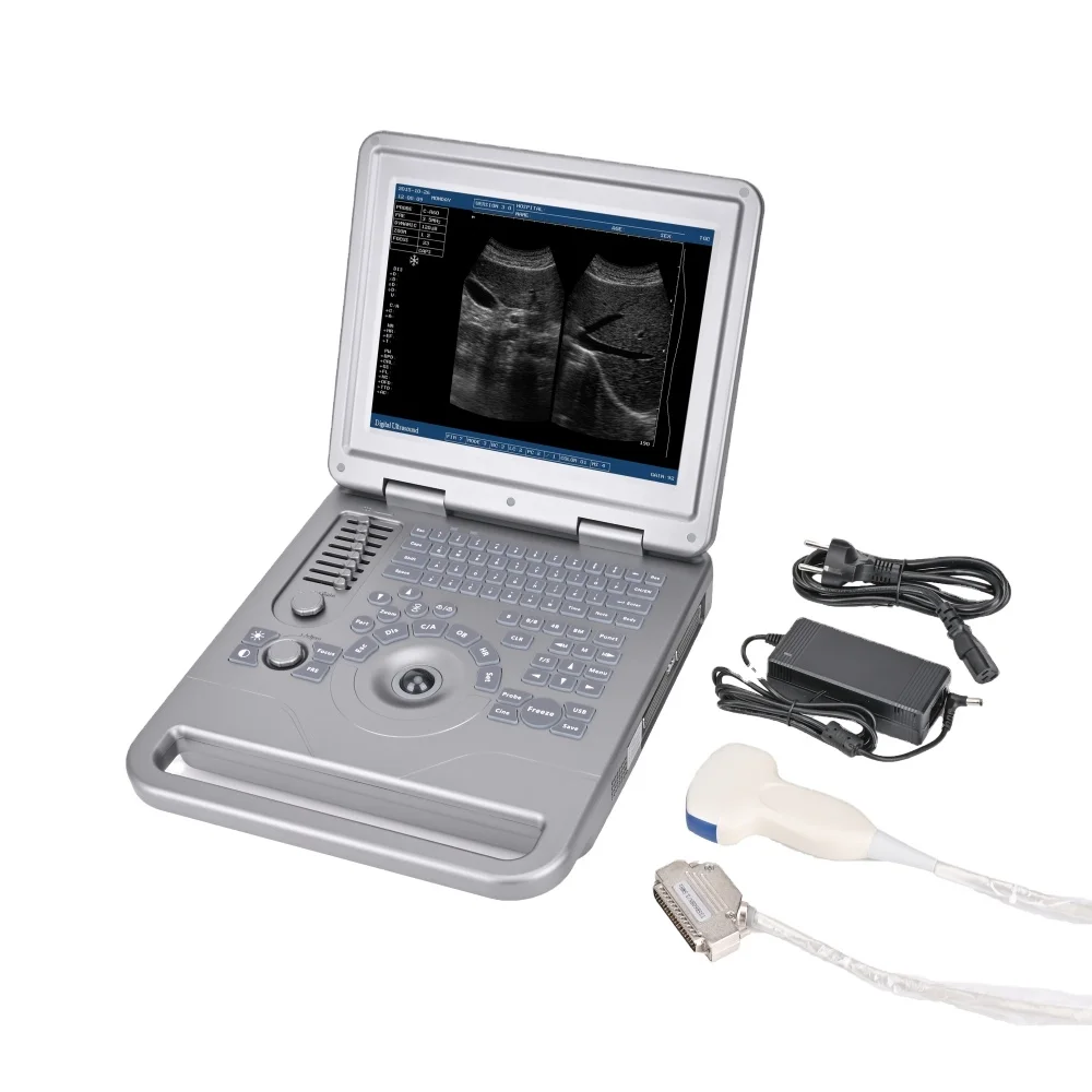 Veterinary Portable Black‑White Ultrasound Scanner, Laptop‑Type B‑Machine for Animal Clinic