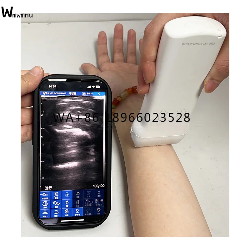 

Emergency surgery anaesthesia used portable linear wireless wifi iphone/pad color doppler ultrasound probe with 192 Elements