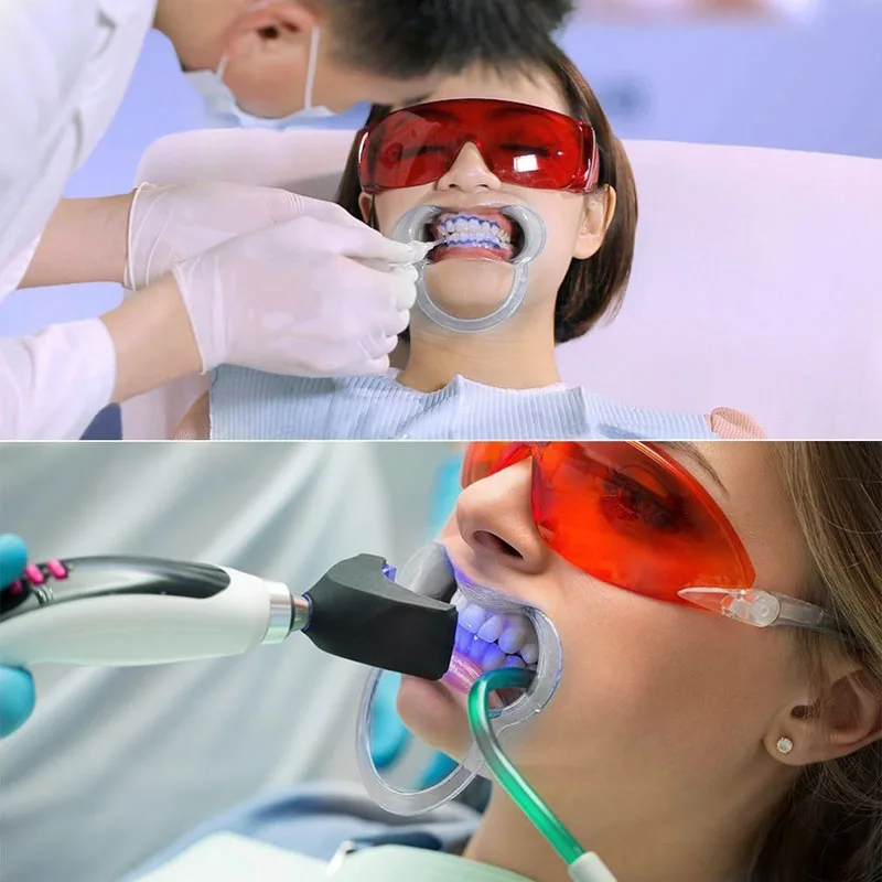 50 sztuk medyczne C kształt Dental ortodoncja otwieracz do ust jednorazowe plastikowe policzek zwijacz wybielanie zębów dentysta narzędzie