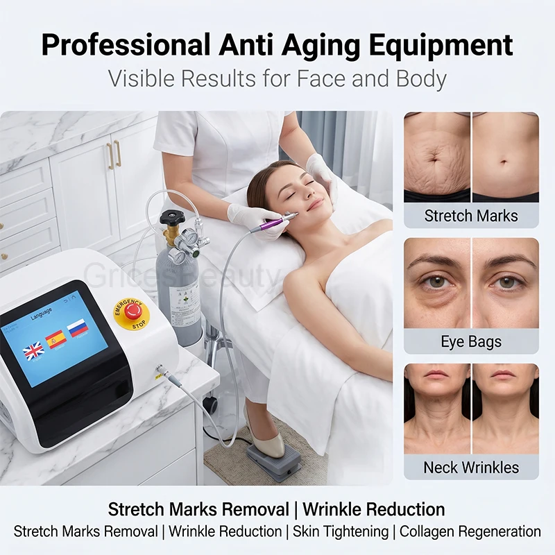 Portable CDT Plus Carboxytherapy Device Crow's Feet Removal Skin Tightening Professional Big Cdt Device
