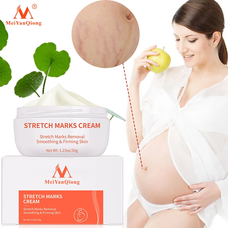 Postpartum repairing body cream, can remove stretch marks and postpartum scars, with a gentle texture and delicate texture