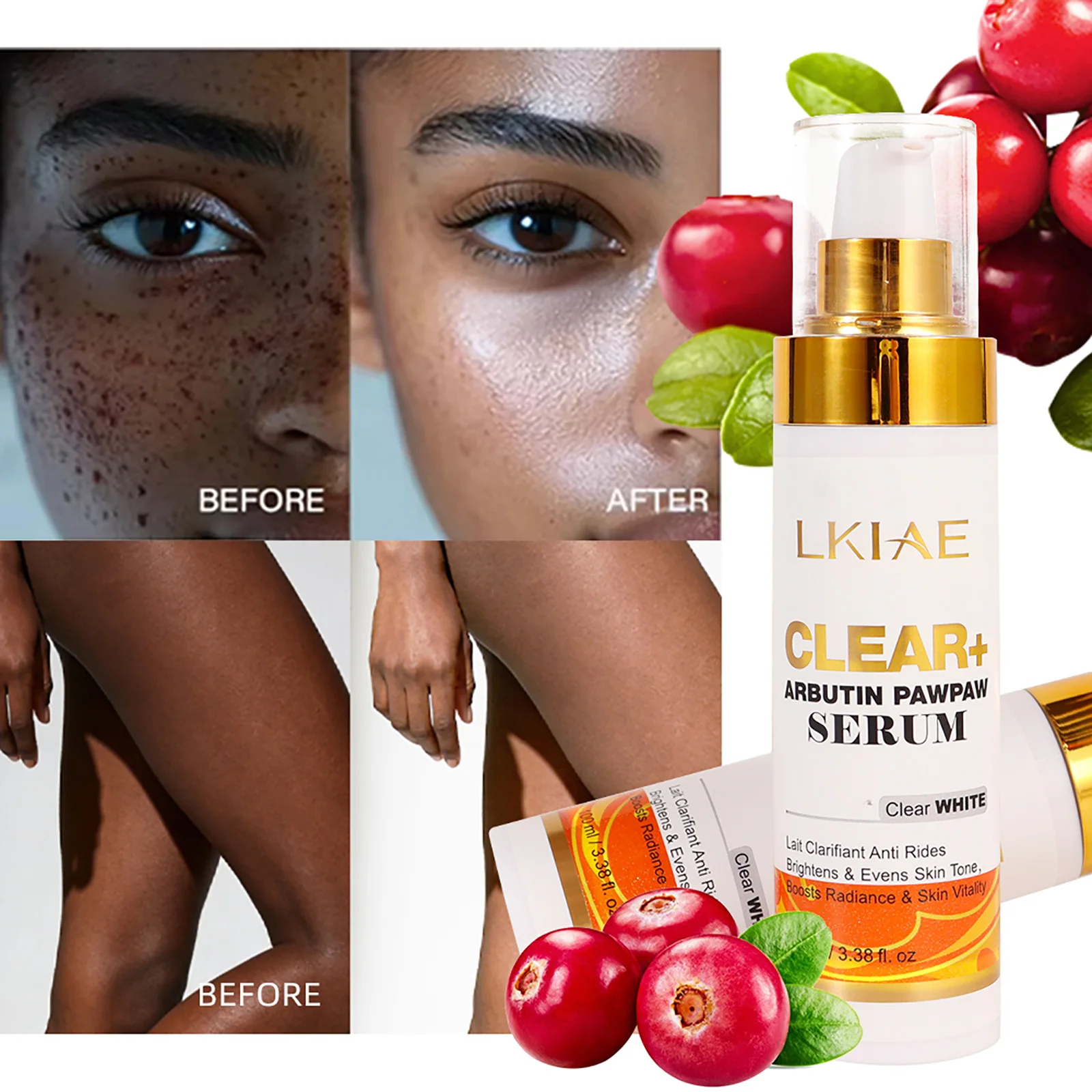 

Сыворотка для осветления кожи LKIAE Clear Arbutin Pawpaw, увлажняющая, осветляющая, выравнивающая тон кожи, удаляющая темные пятна для лица и тела, 100 мл