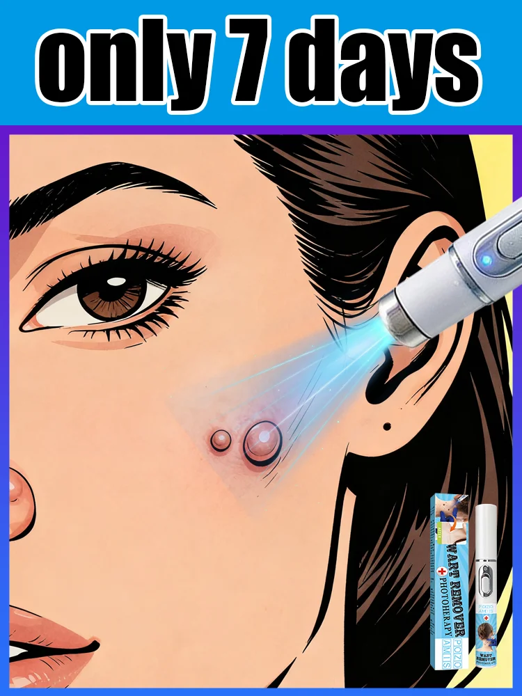 

Generation-3 Laser Says Goodbye To Warts In 7 Days