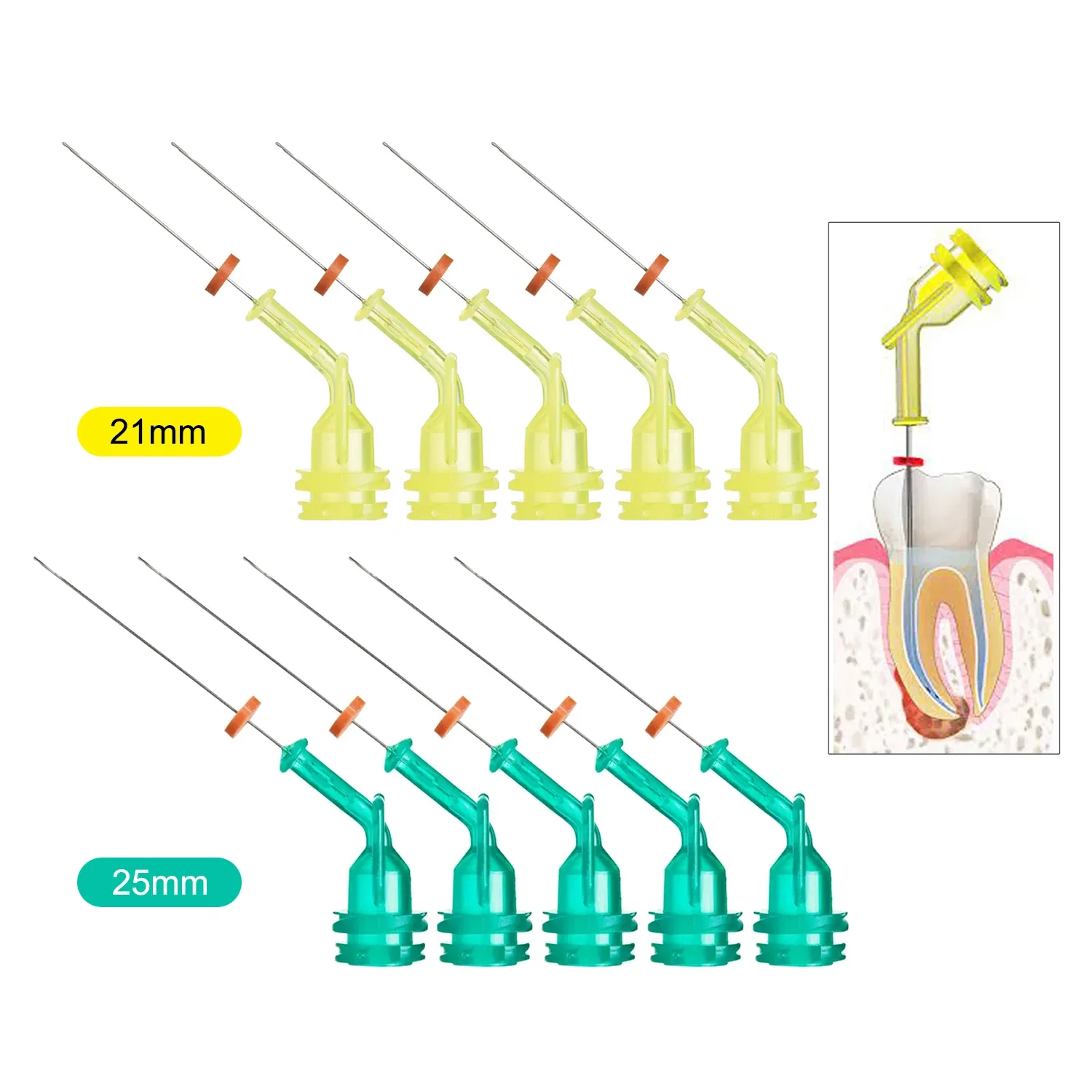 JOLANT 치과 관개 엔도 바늘 팁, 근관 주사기, 전방 어금니, 31G 팔꿈치 양면 구멍, 21mm, 25mm, 10 개