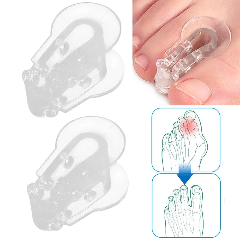 

2pcs=1pair Toe Separators Gel Toe Protector Spreader Cushions Thumb Hallux Valgus Bunion Protector Corrector Pads Foot Care Tool