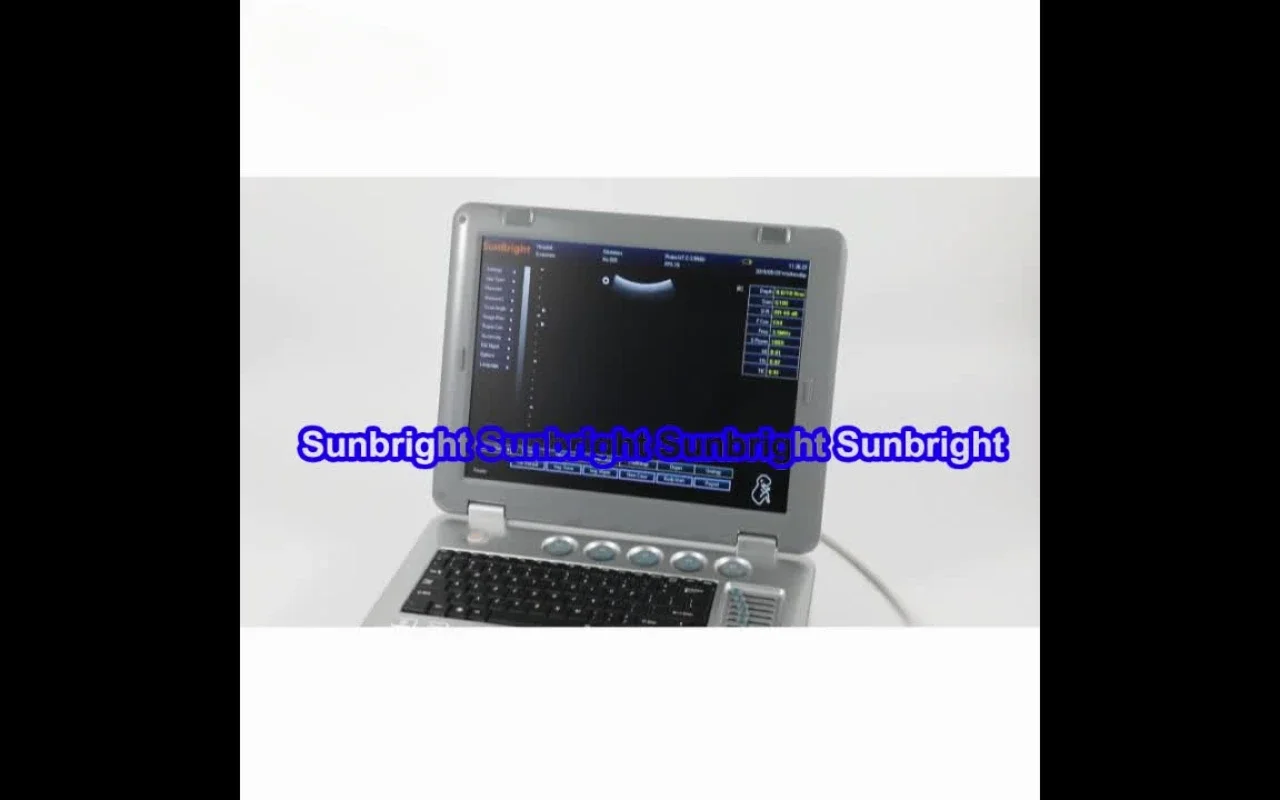 Manufacture price 3D 4D portable color doppler ultrasound