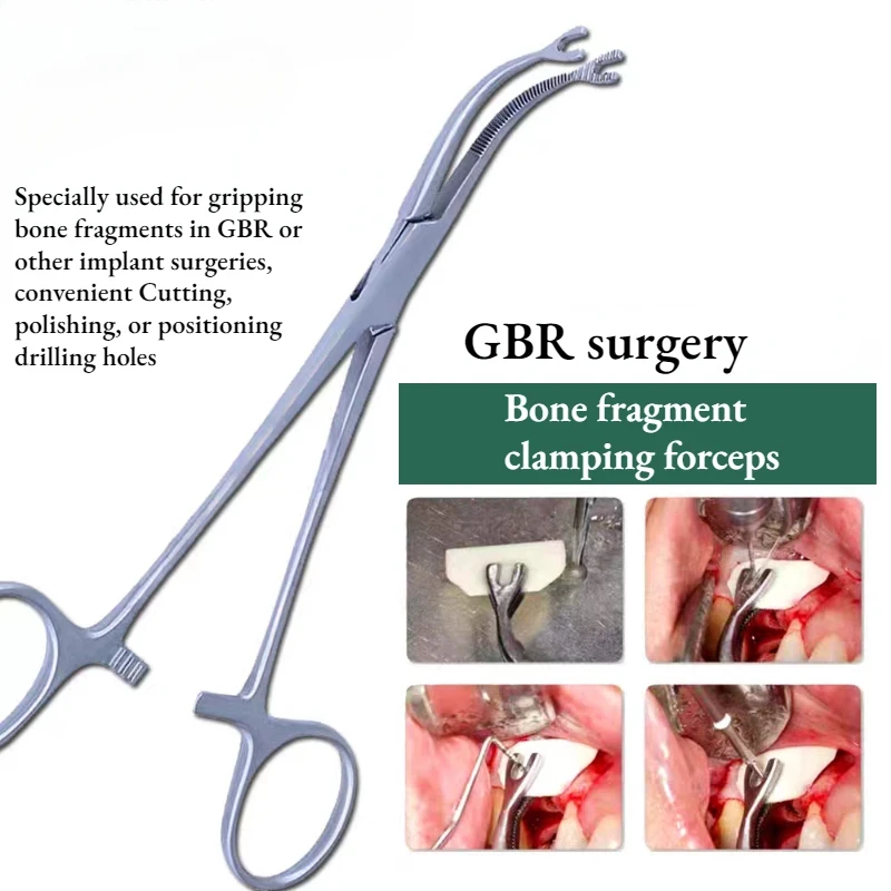 

Dental Non Slip Head with Toothed Bone Clamp Forceps for Implanting Incremental Bone Repair Tools