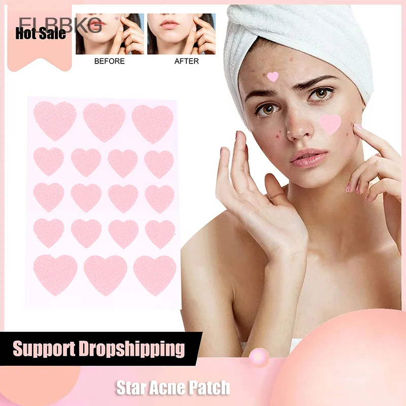 6 Sheets Pink Love Acne Patches Breathable Acne Removal Absorb Secretions Anti Infection Originality Concealer Makeup Tool