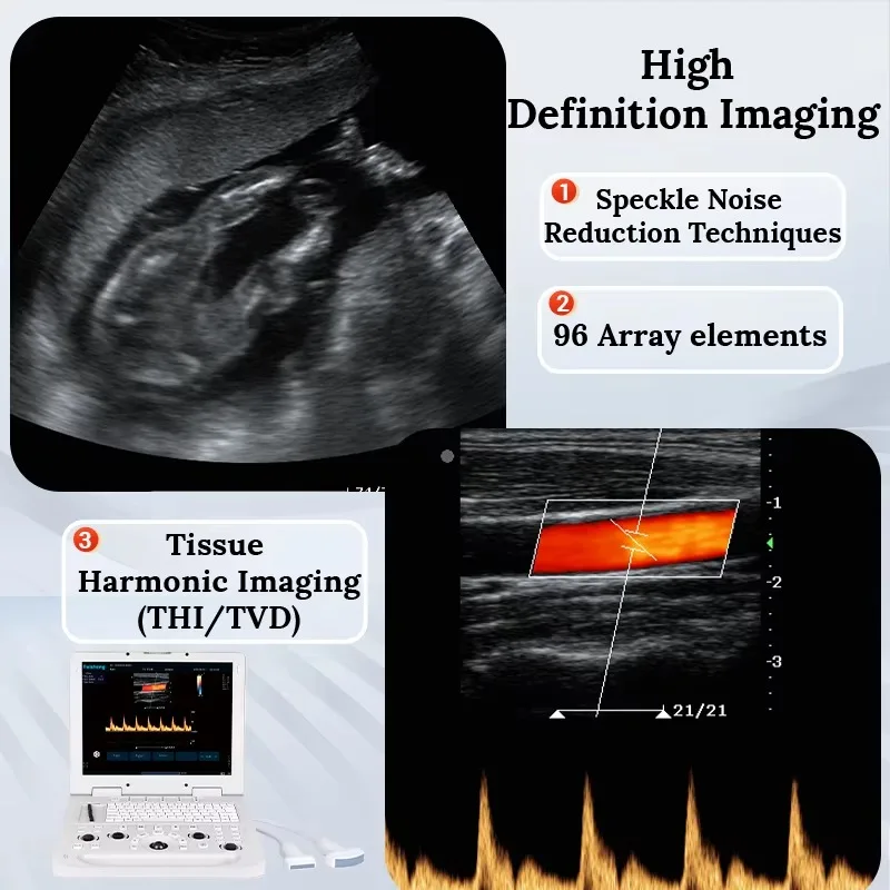 Professional Portable Veterinary Diagnostic Equipment Color Doppler Ultrasound Machine