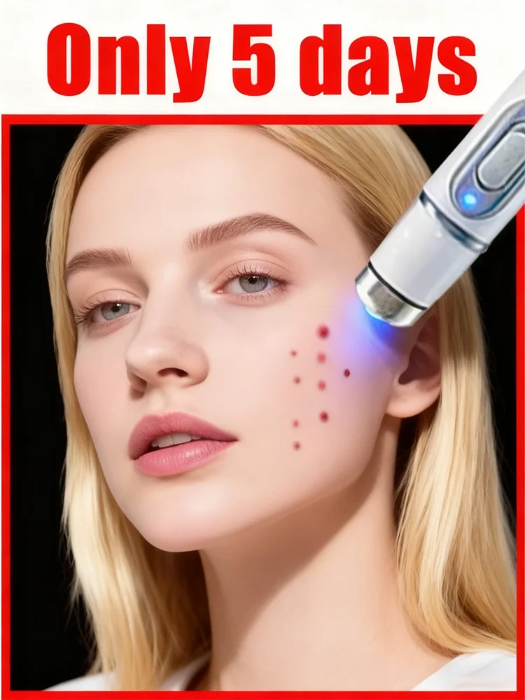 3nd ᵍᵉⁿᵉʳᵃᵗⁱᵒⁿ ᵘᵖᵍʳᵃᵈᵉᵈ wᵃʳᵗ ⸴ ᑫᵘⁱᶜᵏˡʸ， ʳᵉpᵃⁱʳ wᵃʳᵗˢ ʳᵒoᵗ