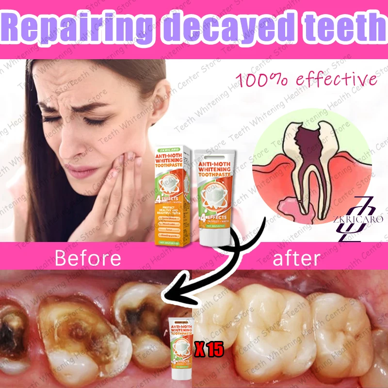 Risolvi problemi di carie dei denti e mantengono i denti sani