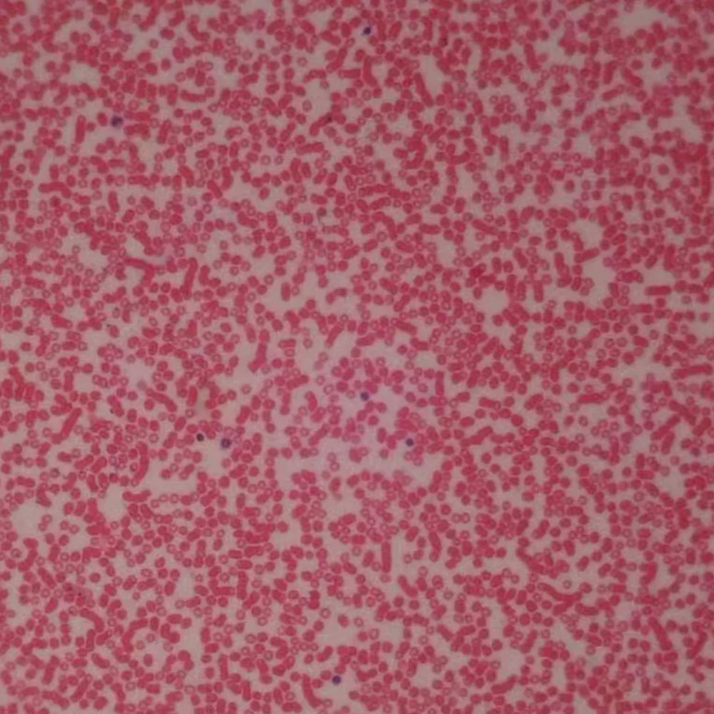 50pcs human prepared blood smear Microscope Glass Slides  Prepared Biological slides Cover Slips in Wood Box