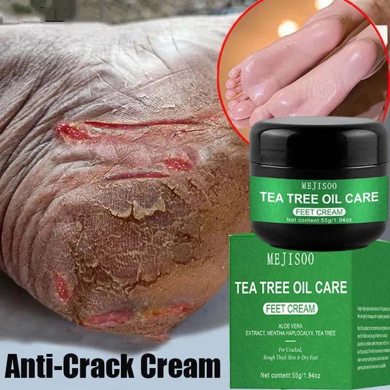 Herbal Anti Crack Foot Cream Heel Cracking Repair Products Exfoliation Dead Skin Removal Softening Moisturize Smooth Skin Care