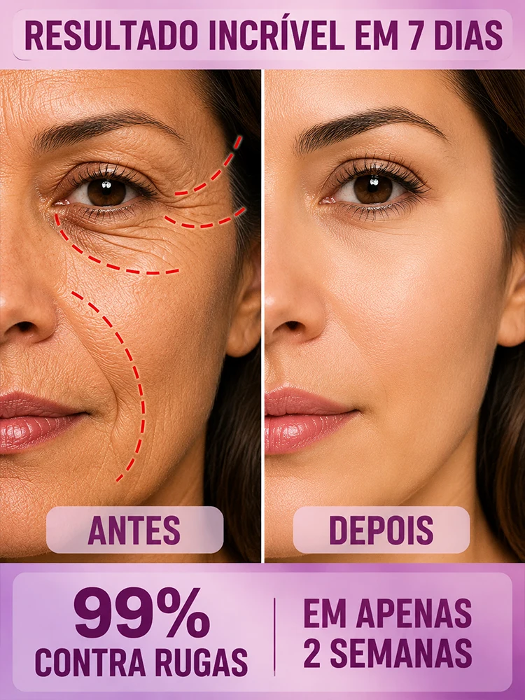 Anti Wrinkle Serum All Skin Types Anti Aging Lifting Serum Fade Deep Wrinkles Restore Youth Skin 20 Years Younger Essence
