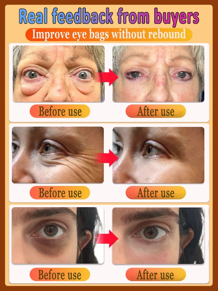 Instant Eye Bag Remover Gel-Cream Erase Bags Under Eyes | Dark Circle Corrector | 7 Days Visible